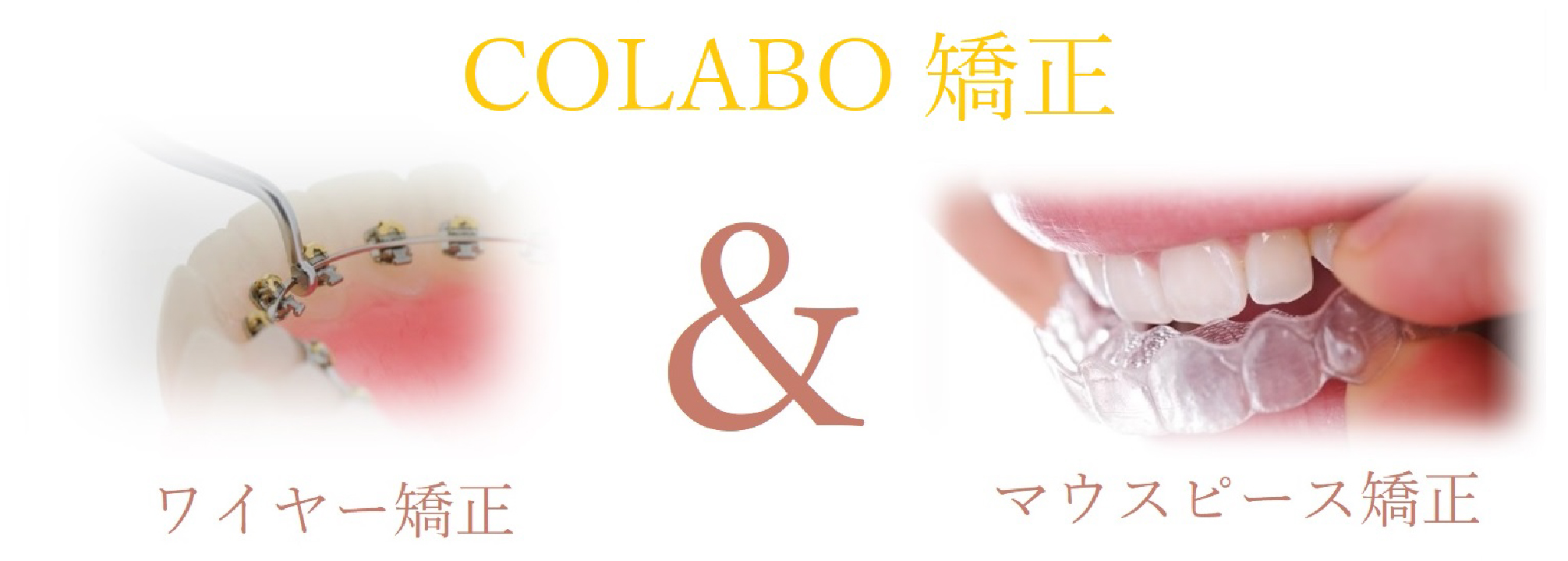 COLLABO矯正