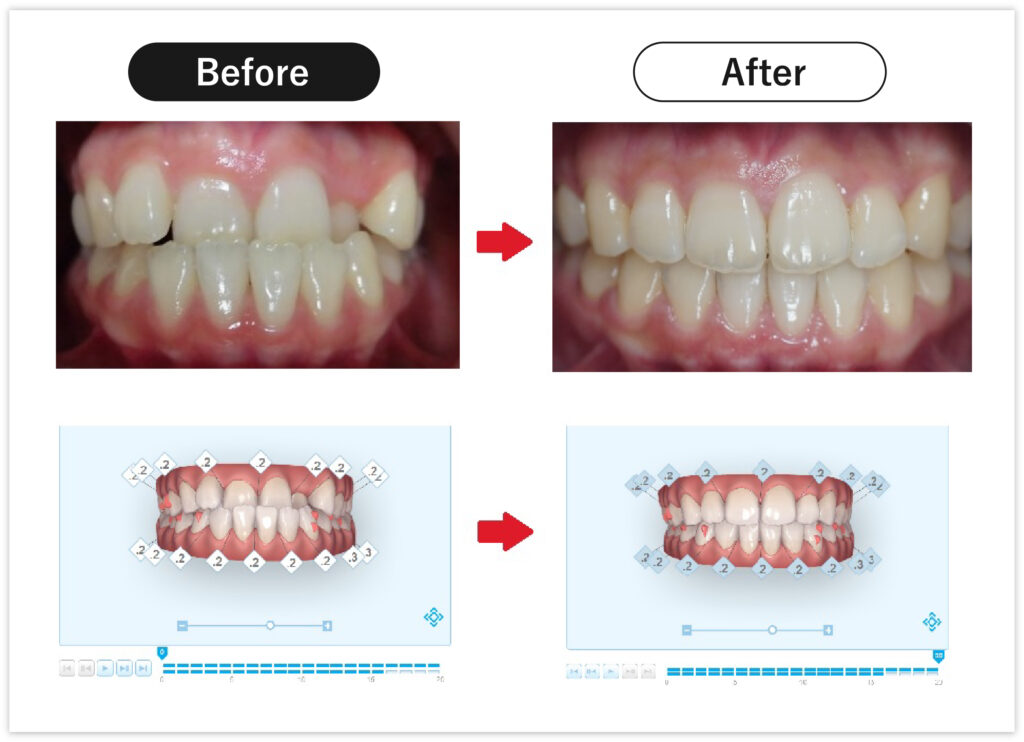 Before/After1