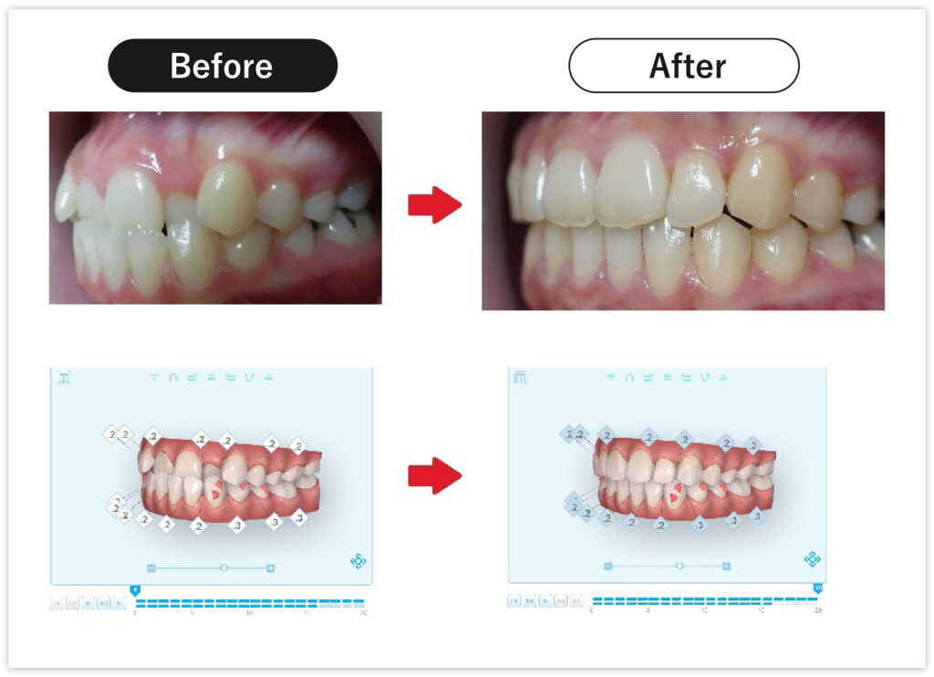 Before/After2